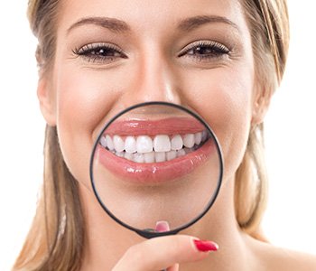 Dr. Clint Bruyere, Clint Bruyere, DDS Patients achieve proper alignment of their teeth with Six Month Smiles treatment in Longview
