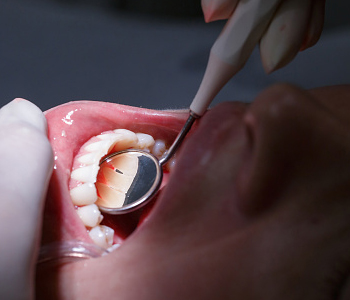Dr. Clint Bruyere, Clint Bruyere, DDS Longview, TX dentist offers professional dental whitening options for patients