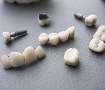 Dr. Clint Bruyere, Clint Bruyere, DDS Explaining Can patients in the Longview area seek restoration with dental implants?